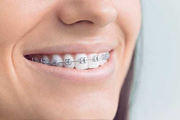 Full Mouth Reconstruction in Universal City, TX